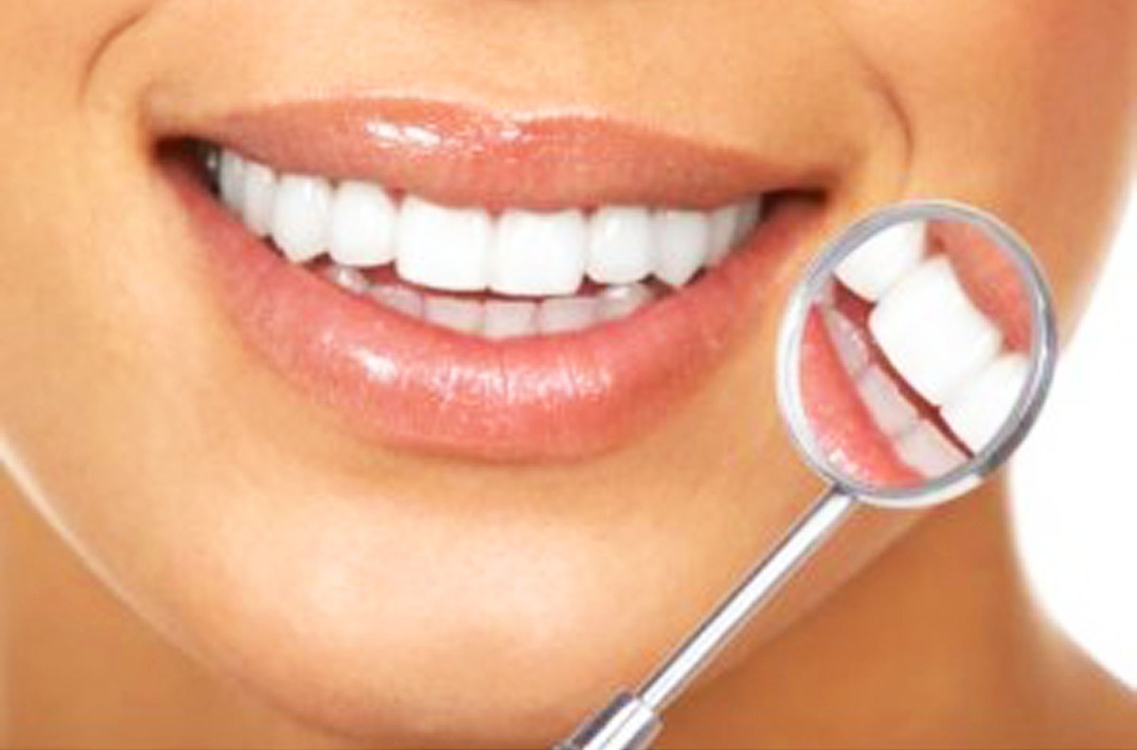 Sourire patient